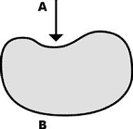 Kidney bean shaped pool